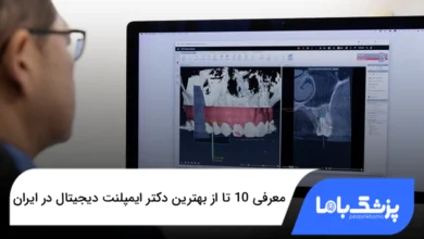 بهترین دکتر ایمپلنت دیجیتال در ایران