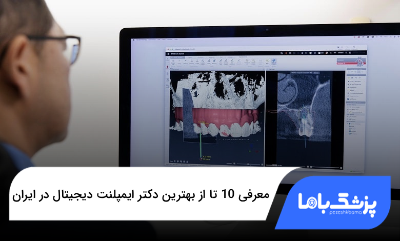 بهترین دکتر ایمپلنت دیجیتال در ایران