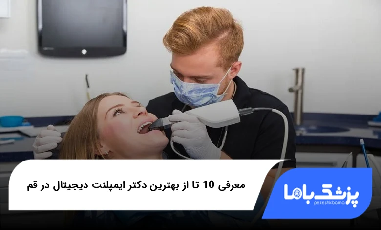 بهترین دکتر ایمپلنت دیجیتال در قم
