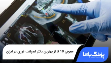 بهترین دکتر ایمپلنت فوری در ایران