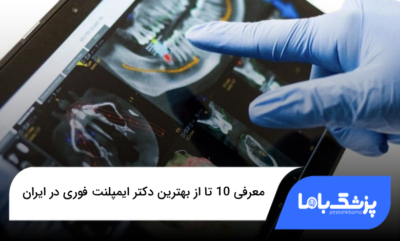 بهترین دکتر ایمپلنت فوری در ایران