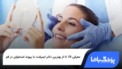 بهترین دکتر ایمپلنت با پیوند استخوان در قم