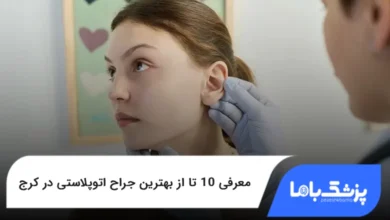 بهترین جراح اتوپلاستی در کرج