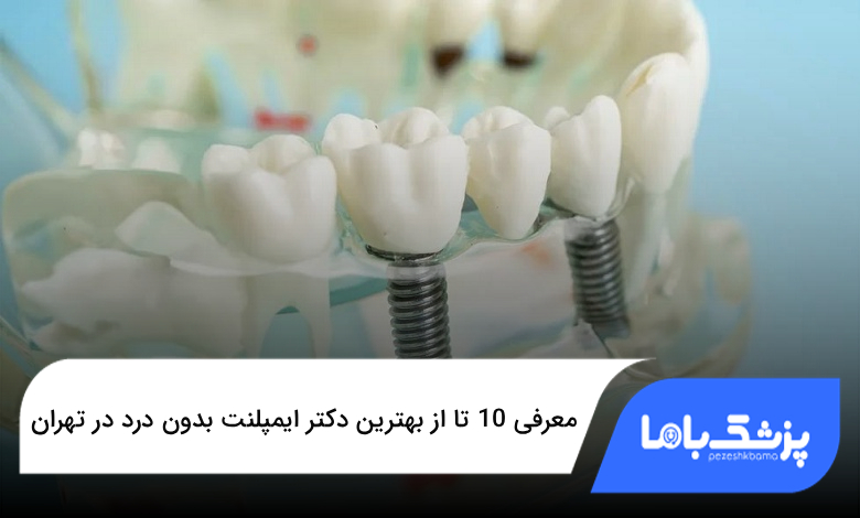 بهترین دکتر ایمپلنت بدون درد در تهران