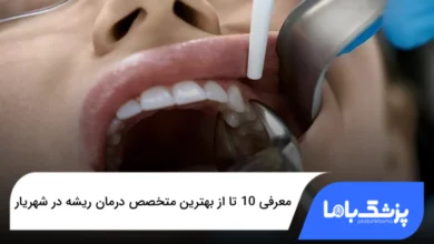 بهترین متخصص درمان ریشه در شهریار