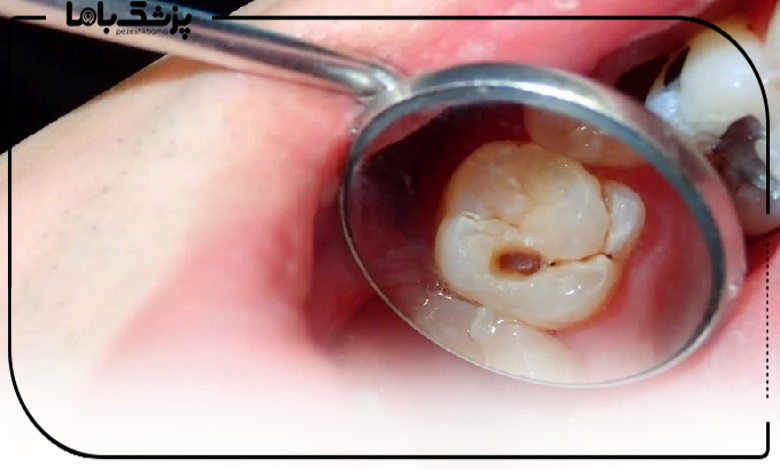 توصیه های بهترین متخصص درمان ریشه در شهریار