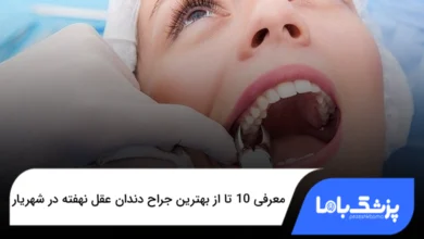 بهترین جراح دندان عقل نهفته در شهریار