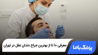 بهترین جراح دندان عقل در تهران