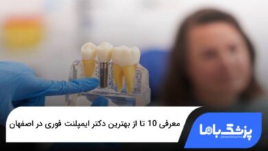 بهترین دکتر ایمپلنت فوری در اصفهان