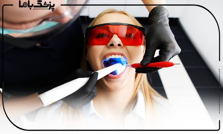 کاندیدای مناسب کامپوزیت لبه شیشهای در کرج