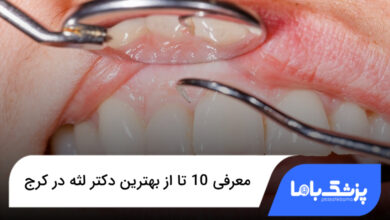 بهترین دکتر لثه در کرج
