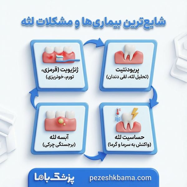 شایع ترین بیماری های لثه