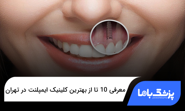 بهترین کلینیک ایمپلنت در تهران