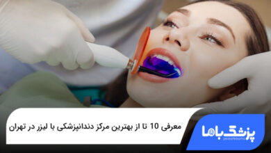 بهترین مرکز دندانپزشکی با لیزر در تهران