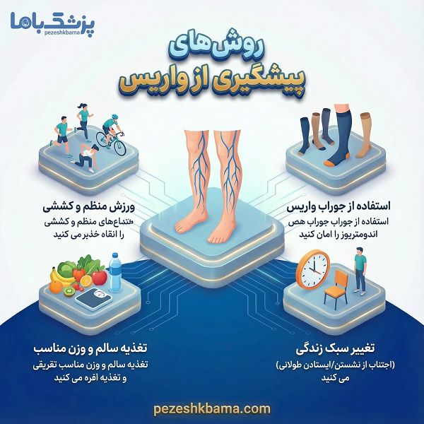 روش های پیشگیزی از واریس