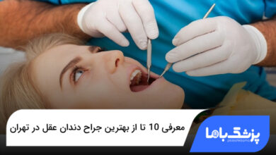 بهترین جراح دندان عقل در تهران