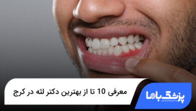 بهترین دکتر لثه در کرج