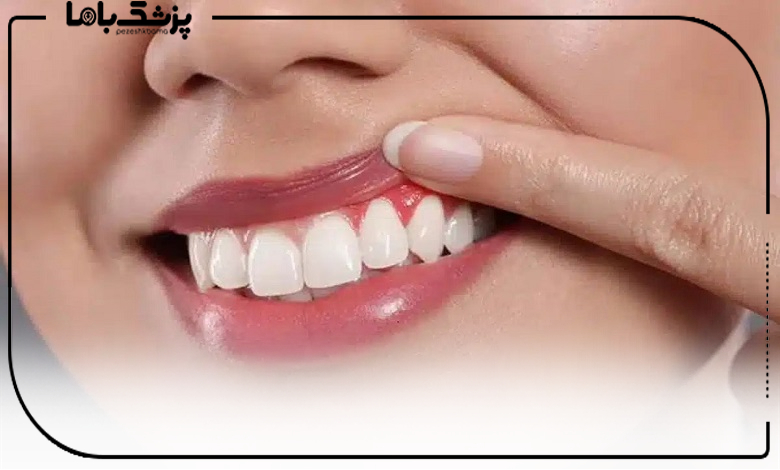 راهنمای انتخاب بهترین دکتر لثه در شهرک غرب