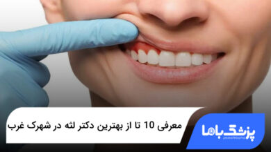 بهترین دکتر لثه در شهرک غرب