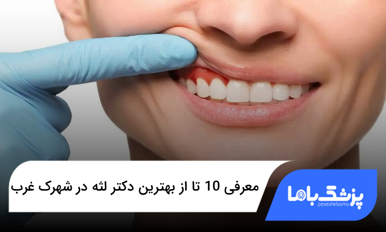 بهترین دکتر لثه در شهرک غرب