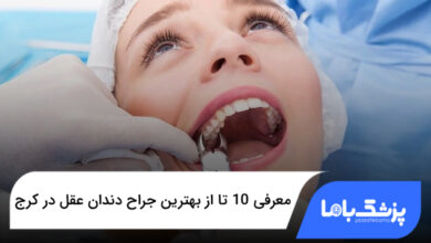 the-best-wisdom-tooth-surgeon-in-karaj