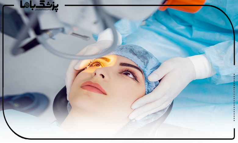 مراحل انجام لیزیک