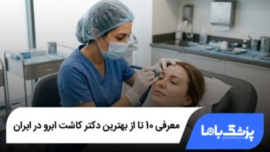 بهترین دکتر کاشت ابرو در ایران