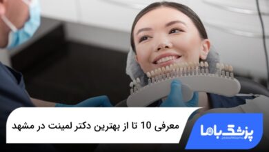 بهترین دکتر لمینت در مشهد
