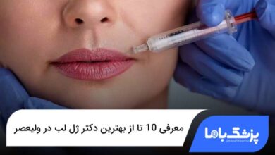بهترین دکتر ژل لب در ولیعصر