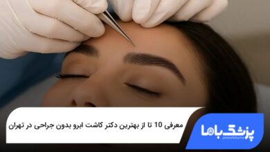 بهترین دکتر کاشت ابرو بدون جراحی در تهران