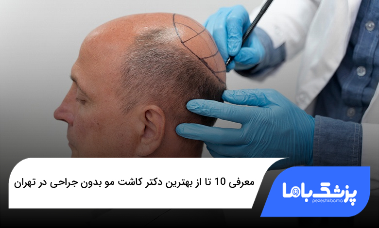 بهترین دکتر کاشت مو بدون جراحی در تهران