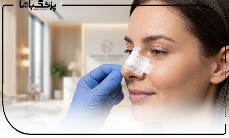 چسب زدن بینی بیمار توسط بهترین جراح بینی در کرج