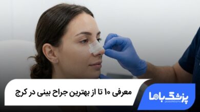 بهترین جراح بینی در کرج