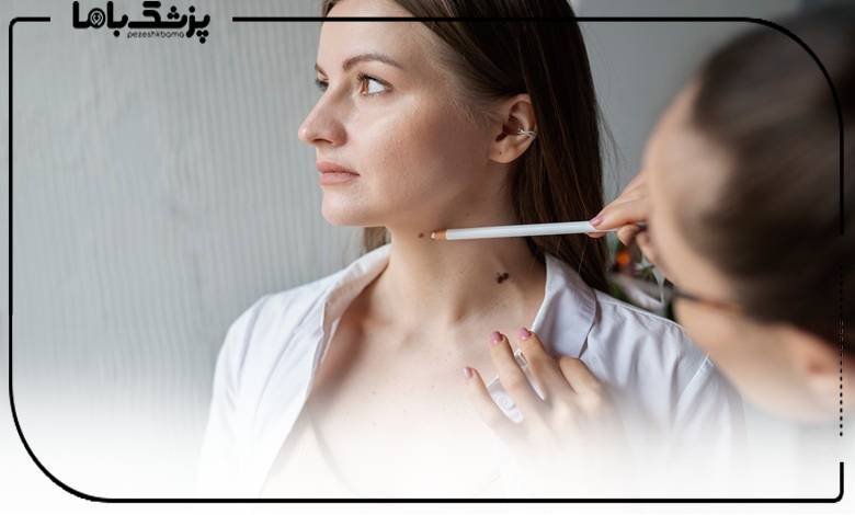 توصیههای بهترین مرکز خالبرداری در سعادت آباد