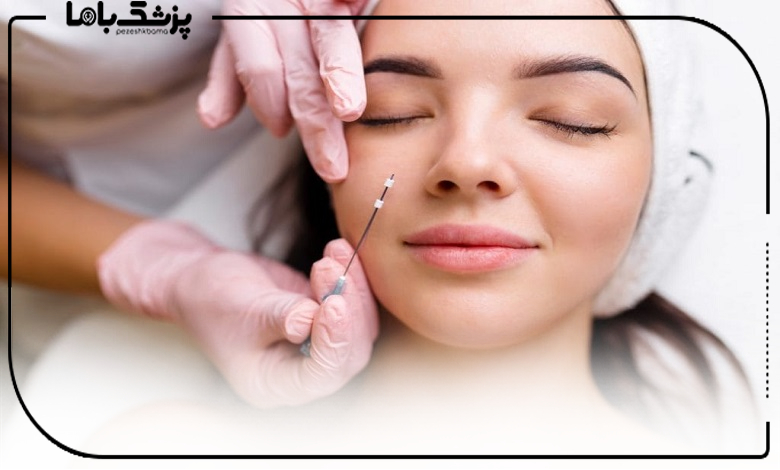 تفاوت لیفت با نخ کاگ و مونو در کلینیکهای تهران