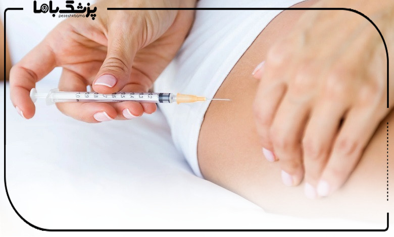 معیارهای انتخاب دکتر فیلر بادی در جنوب تهران