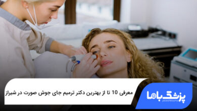 بهترین دکتر ترمیم جای جوش صورت در شیراز