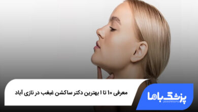 بهترین دکتر ساکشن غبغب در نازی آباد