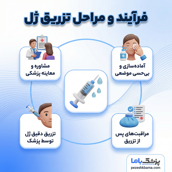فرآیند و مراحل تزریق ژل
