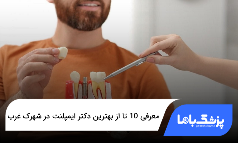 بهترین دکتر ایمپلنت در شهرک غرب
