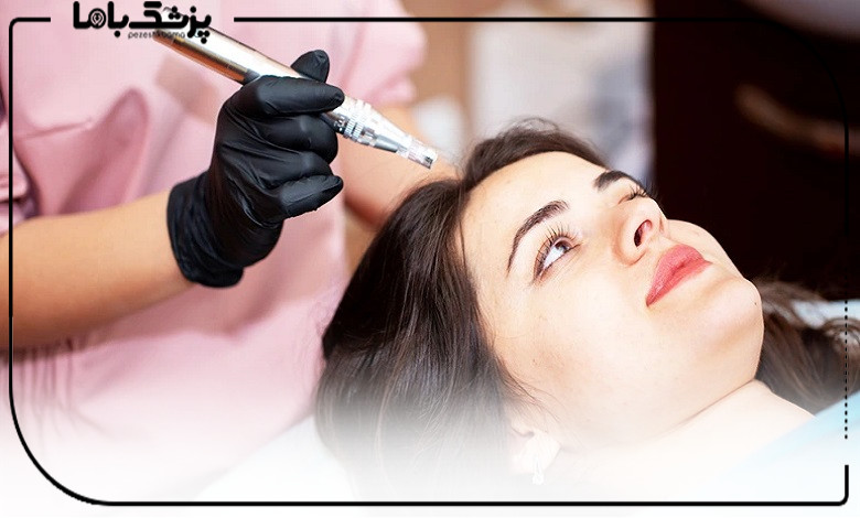 راهنمای انتخاب دکتر مزوتراپی در شهرک غرب