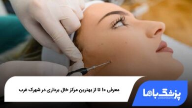 بهترین مرکز خال برداری در شهرک غرب