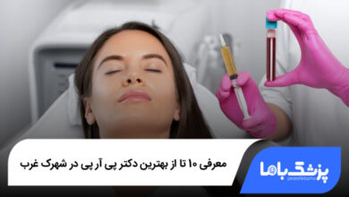 بهترین دکتر پی آر پی در شهرک غرب