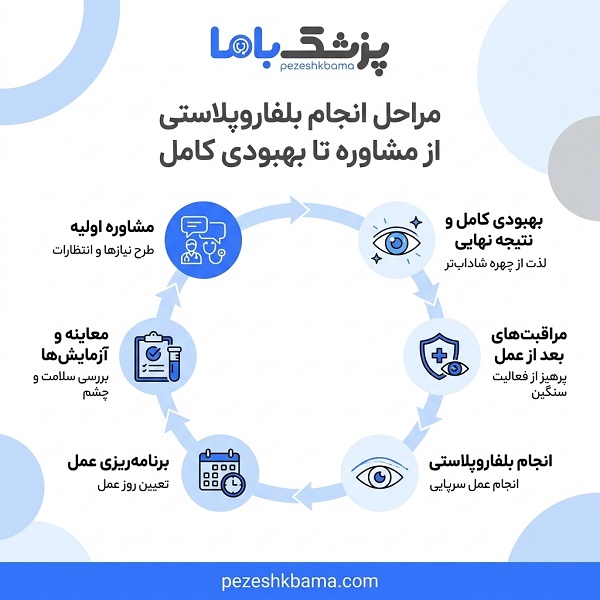 مراحل انجام بلفاروپلاستی از مشاوره تا بهبودی کامل