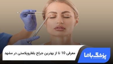 بهترین جراح بلفاروپلاستی در مشهد