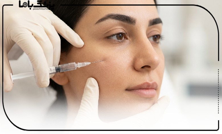 تزریق ژل صورت توسط بهترین دکتر تزریق ژل در کرج