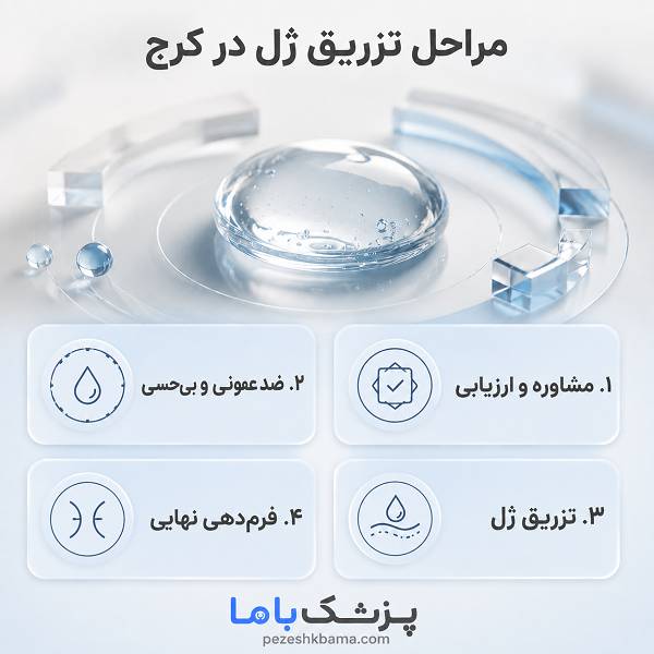 مراحل تزریق ژل در کرج