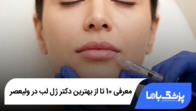 بهترین دکتر ژل لب در ولیعصر