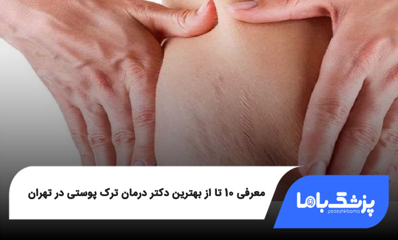 بهترین دکتر درمان ترک پوستی در تهران