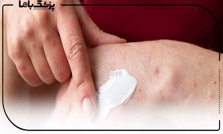 معیارهای انتخاب بهترین دکتر درمان ترک پوستی